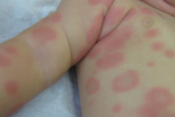 Пылесос thomas allergy &amp; family